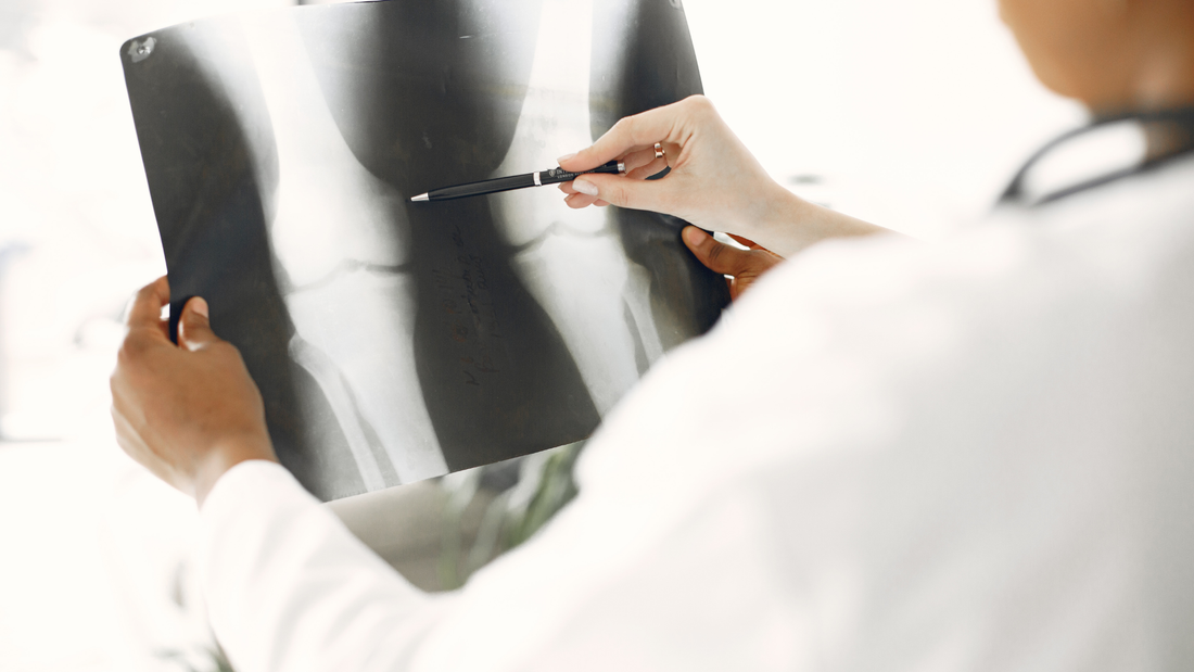 Boron Benefits: Bone Health to Hormonal Harmony