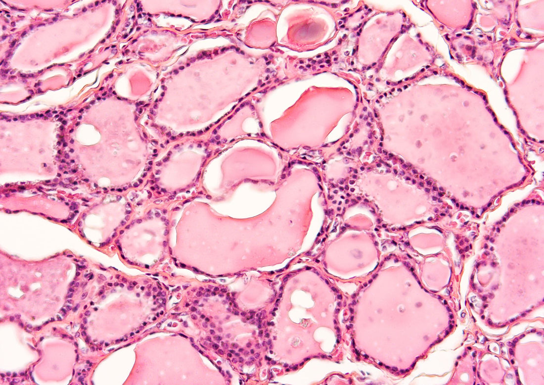 microscopic photograph of human muscle cells: cellular energy