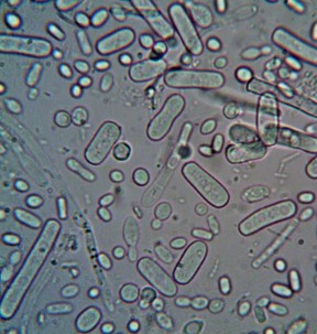 Gut Health: The benefits of L. reuteri (DSM 17648)