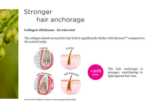 Keranat Hair Loss Reduction & Hair Growth for Women