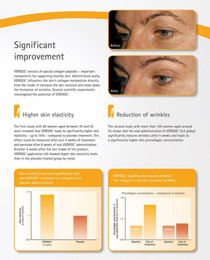 Ultra Collagen Complex – Types I, II, III, V & X with VERISOL® – Skin, Joints & Hair Health