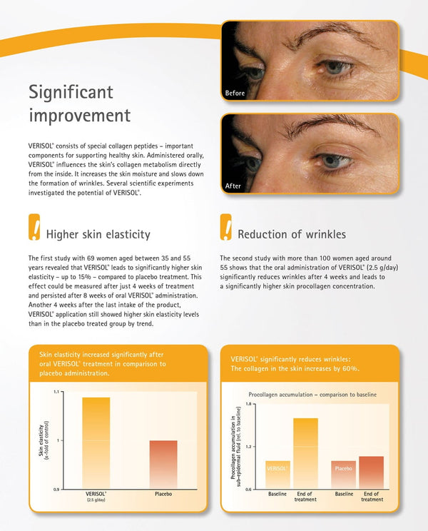 Ultra Collagen Complex – Types I, II, III, V & X with VERISOL® – Skin, Joints & Hair Health